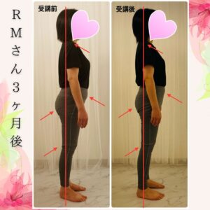 RMさん３ヶ月後変化