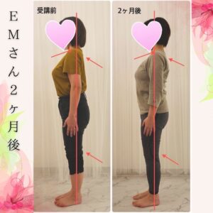 EMさん２ヶ月後変化