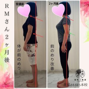 RMさん２ヶ月後変化