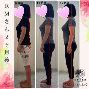 RMさん２ヶ月後変化