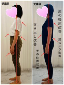 RTさん姿勢変化 受講後