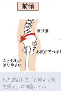 反り腰治し方「姿勢よく胸を張る」の間違いとは