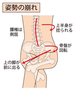 足を組む時のゆがみ　姿勢